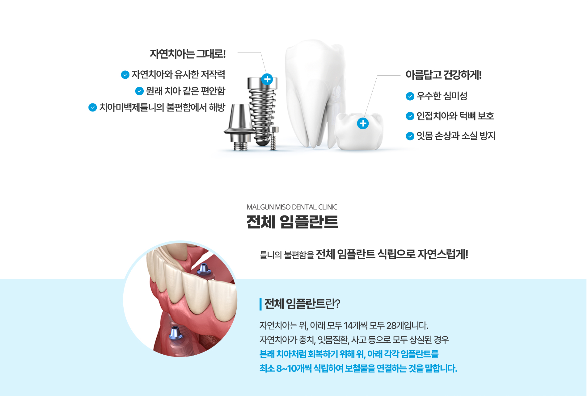 전체임플란트